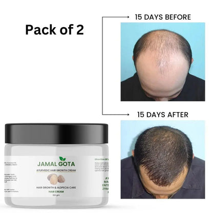 Jamalgota Ayurvedic Hair Growth Cream 100gm (Pack of 2)